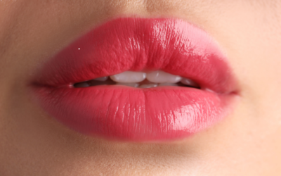 Bullhorn Lip Lift ilə dodağın təbii görünüşü