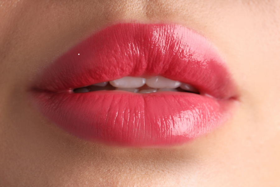 Bullhorn Lip Lift ilə dodağın təbii görünüşü