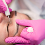 Blefaroplastika nədir? Göz qapağı estetikası və bərpa prosesi