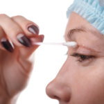 Blefaroplastikadan sonra nələr baş verir? Bərpa və nəticə