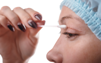Blefaroplastikadan sonra nələr baş verir? Bərpa və nəticə
