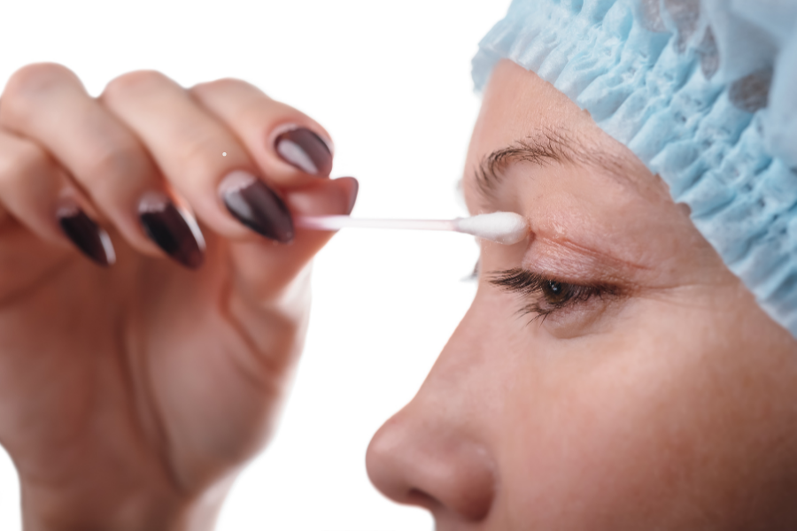 Blefaroplastikadan sonra nələr baş verir? Bərpa və nəticə