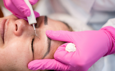 Blefaroplastika nədir? Göz qapağı estetikası və bərpa prosesi